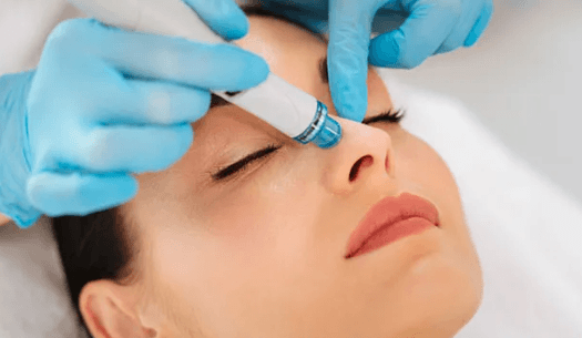 Why HydraFacial Is Trending for Instant Glow